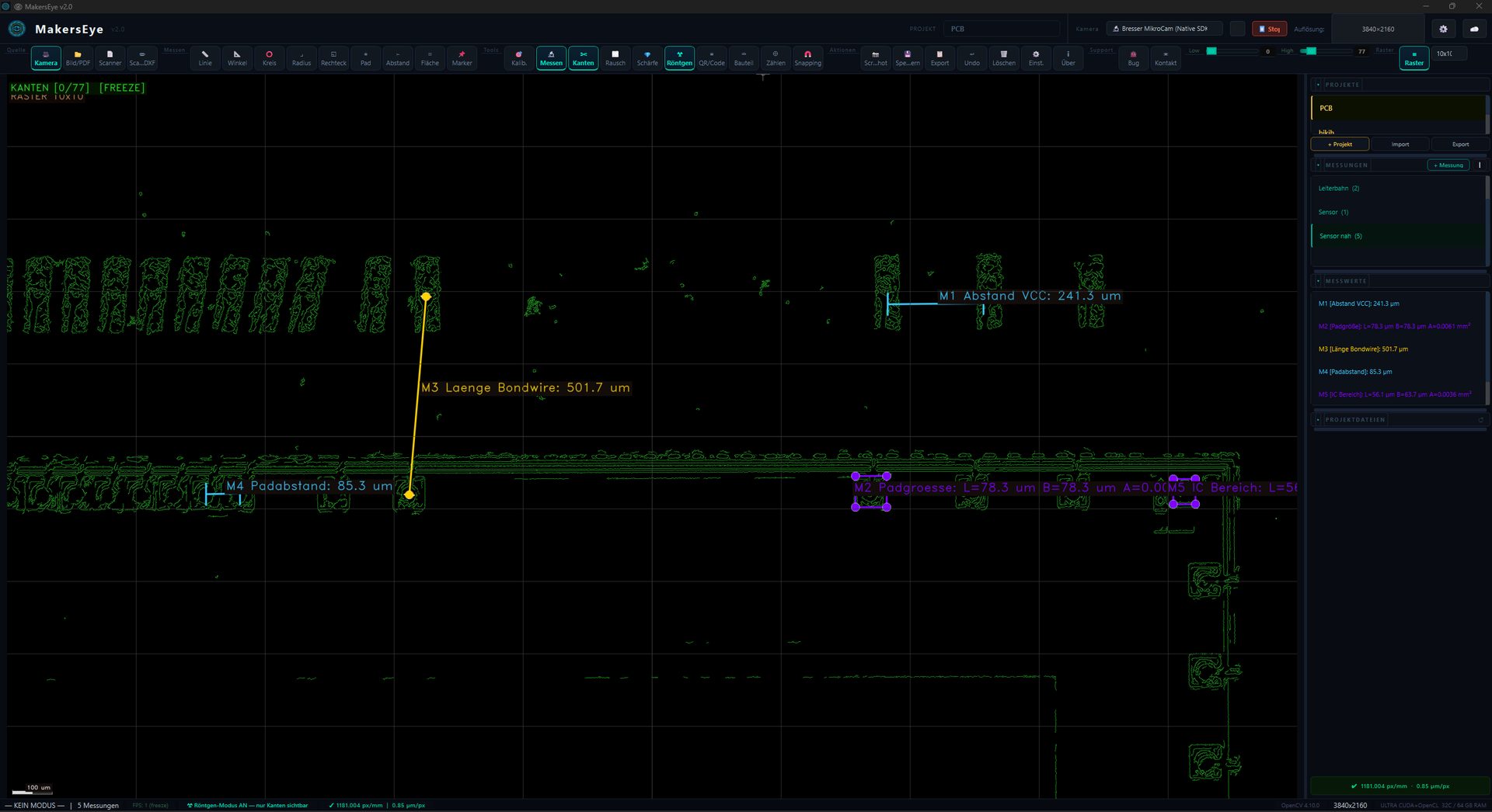 Bondwire Röntgen-Modus